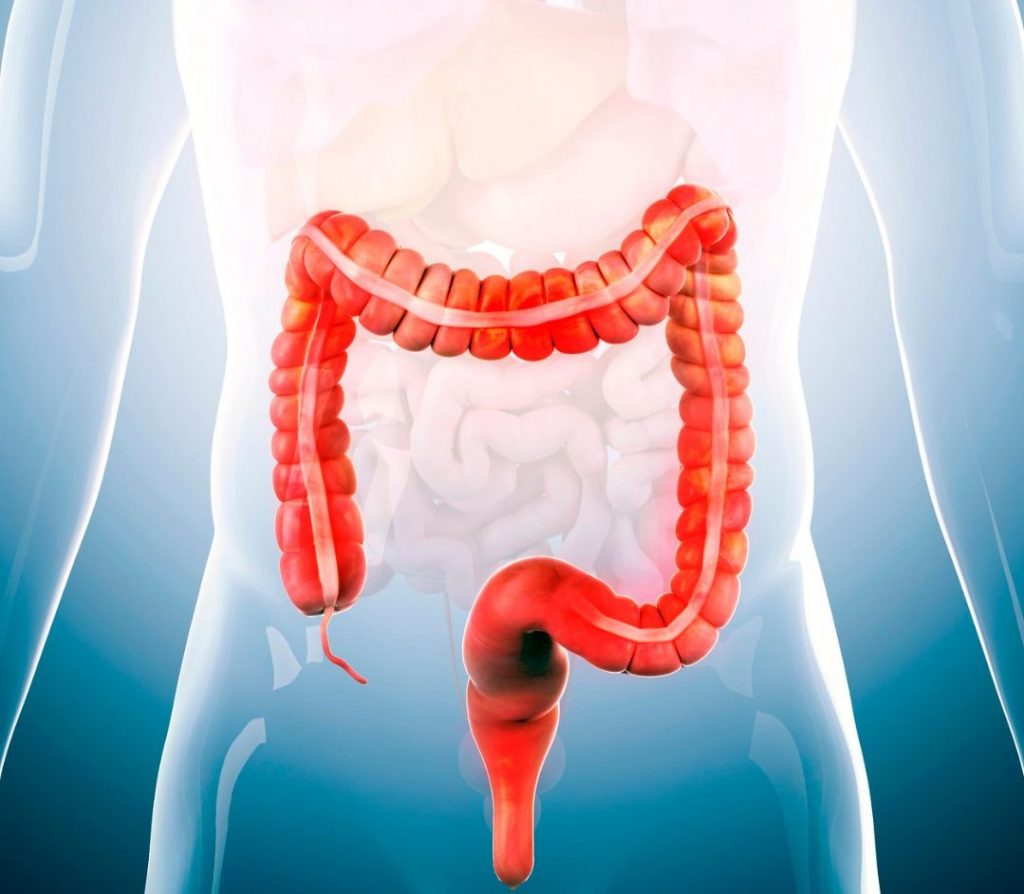 Alimentazione nella sindrome dell’Intestino Irritabile